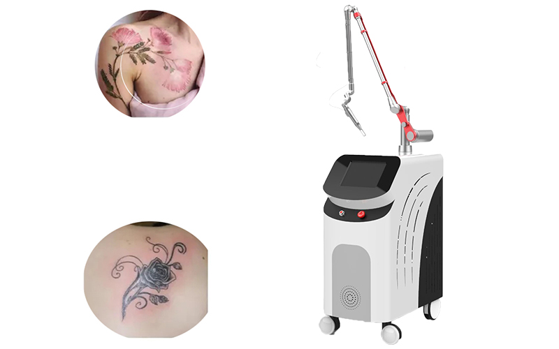  Picosecond Q-Switched Tattoo Removal Machine