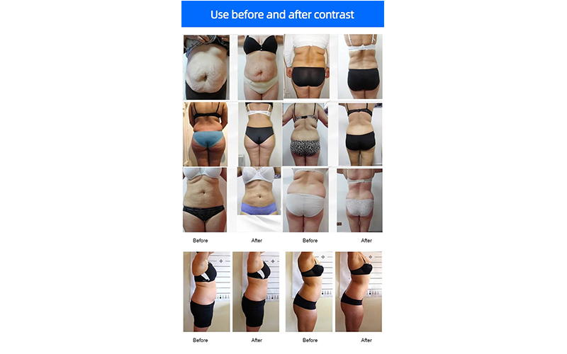6D 5d Laser Led Therapy Machine 635nm 650nm Body Slimming Lipolaser Slimming Machine