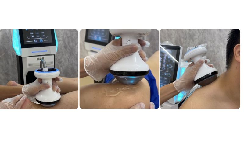 Focused Shockwave ED Treatment Pain Relief Physiotherapy Machine
